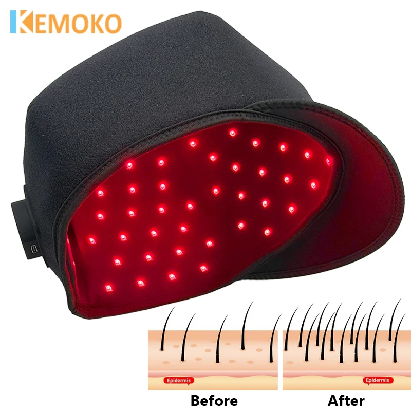 Red Light Therapy Cap Laser 660nm 880nm Red Near Infrared Hair Regrowth Hat Hair Loss for Regrowth Anti Loss Hair Relax Care