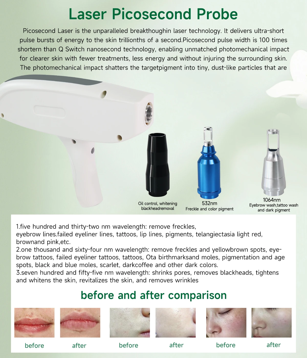 Yag Laser Handle Tip Head Lens 1064nm 1320nm Pico Laser Hair Removal Tatto Removalmachine , Skin Care Beauty Machine Accessories