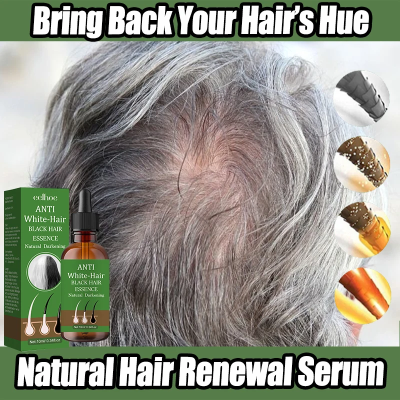Gray To Black Hair Oil Reduces Premature Graying  Nourishes Follicles Restores Natural Black Pigment Darkening Gray/white Hair