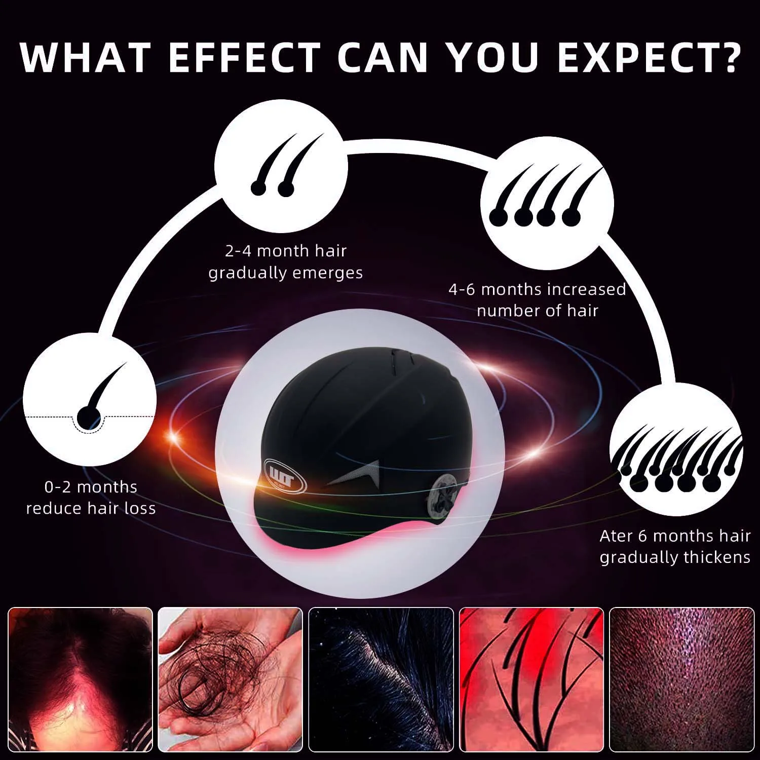 Red Light Laser Hair Growth Helmet for Anti Hair Loss Laser Hair Regrowth Therapy